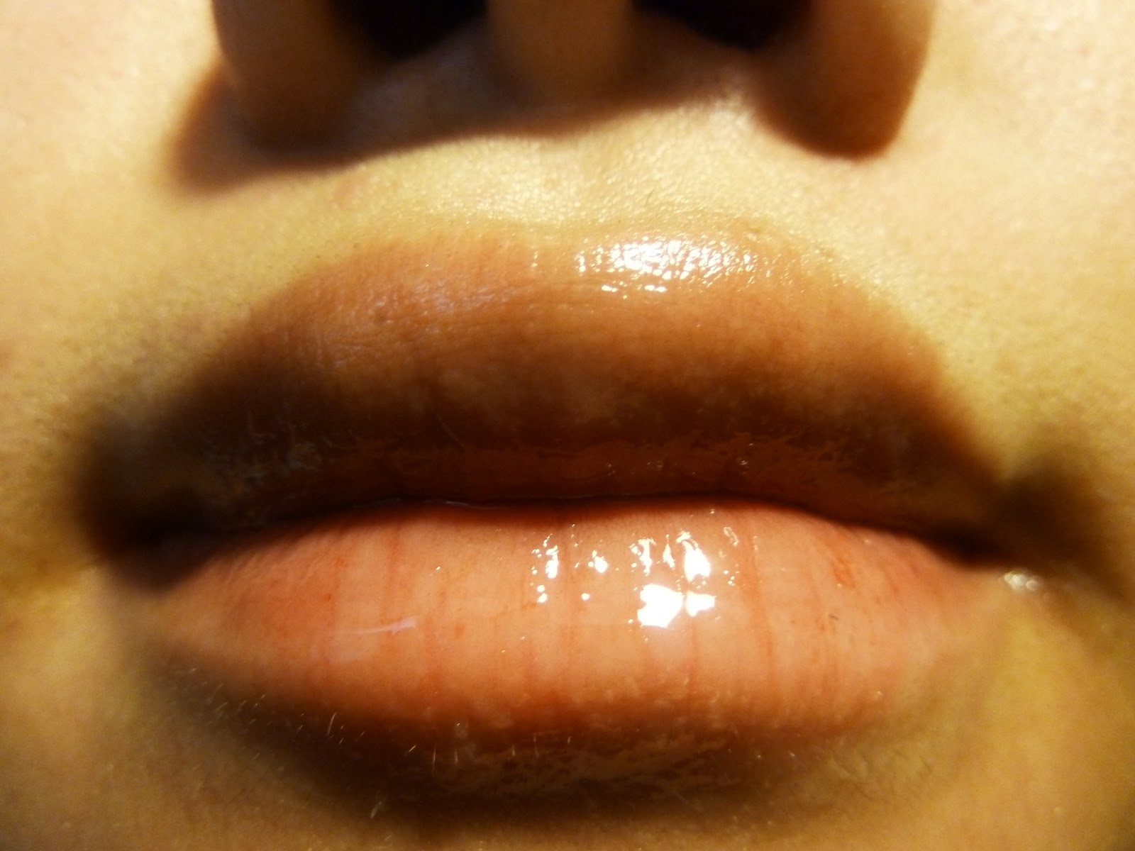 Solution to Chapped Lips Zowie Power