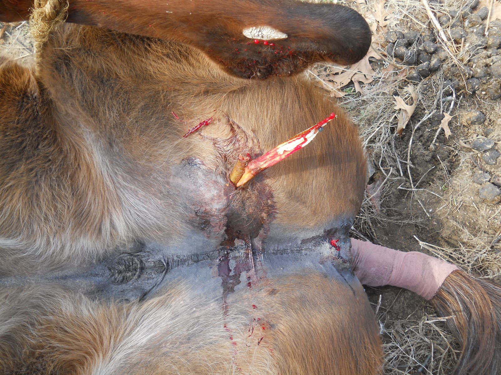 Cracked Pelvis Recovery