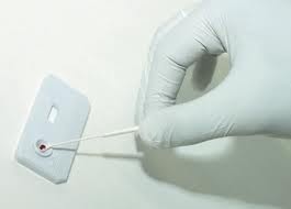 Exame elisa hiv