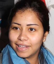 بالفيديو شيرين قبل وبعد التجميل مراحل تغير شكل شيرين