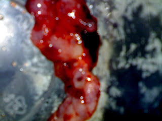 Apabila Adriana Berbicara: Keguguran