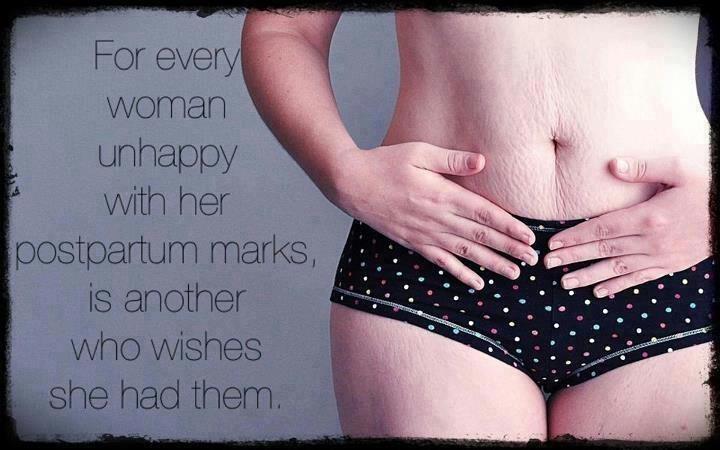 For+every+woman+unhappy+with+her+postpartum+marks,+is+another+who+wishes+she+had+them+.jpg