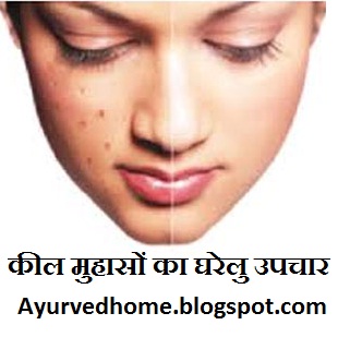 Ayurvedic Home Remedies to remove pimples from face in hindi 