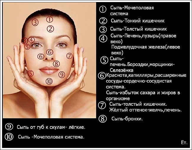 Желтая кожа на лбу Желтая кожа на лбу