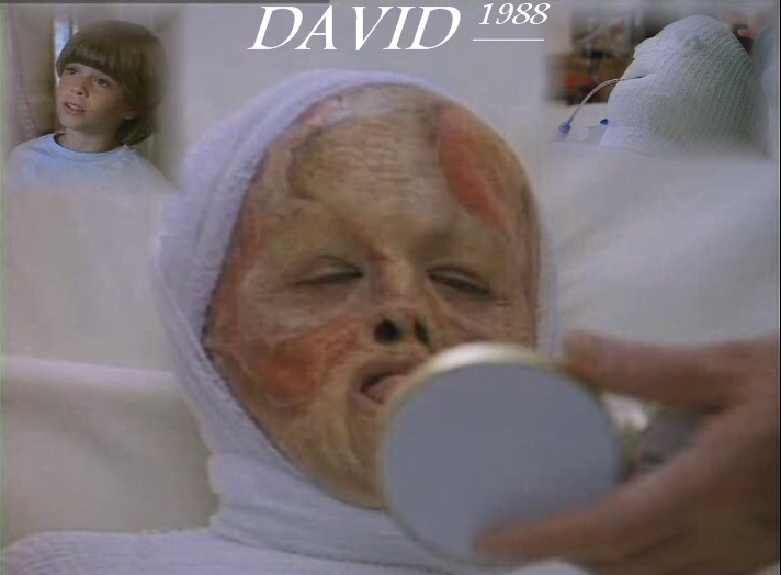 David 1988