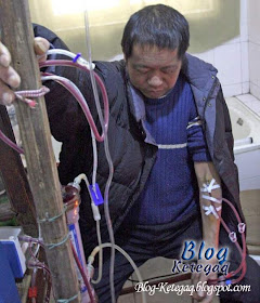 Mesin hemodialisis buatan sendiri