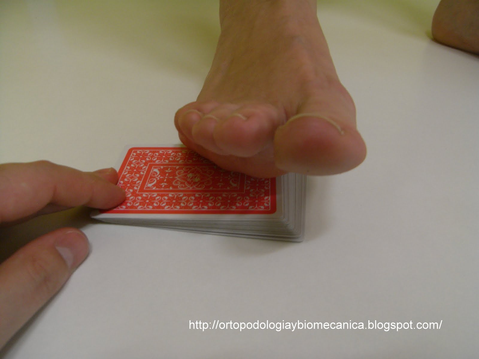 Ortopodologia y Biomecanica HALLUX LIMITUS FUNCIONAL Y WEDGE