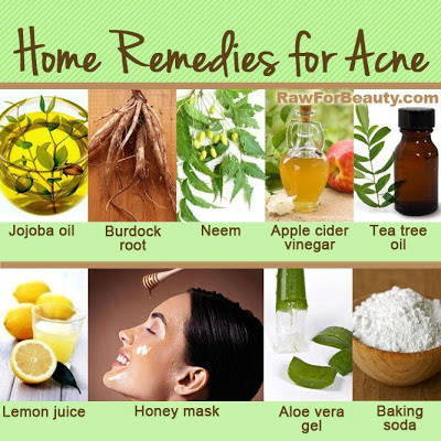 Beauty tips for face-Remedies for Acne