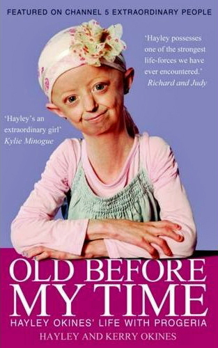family with progeria