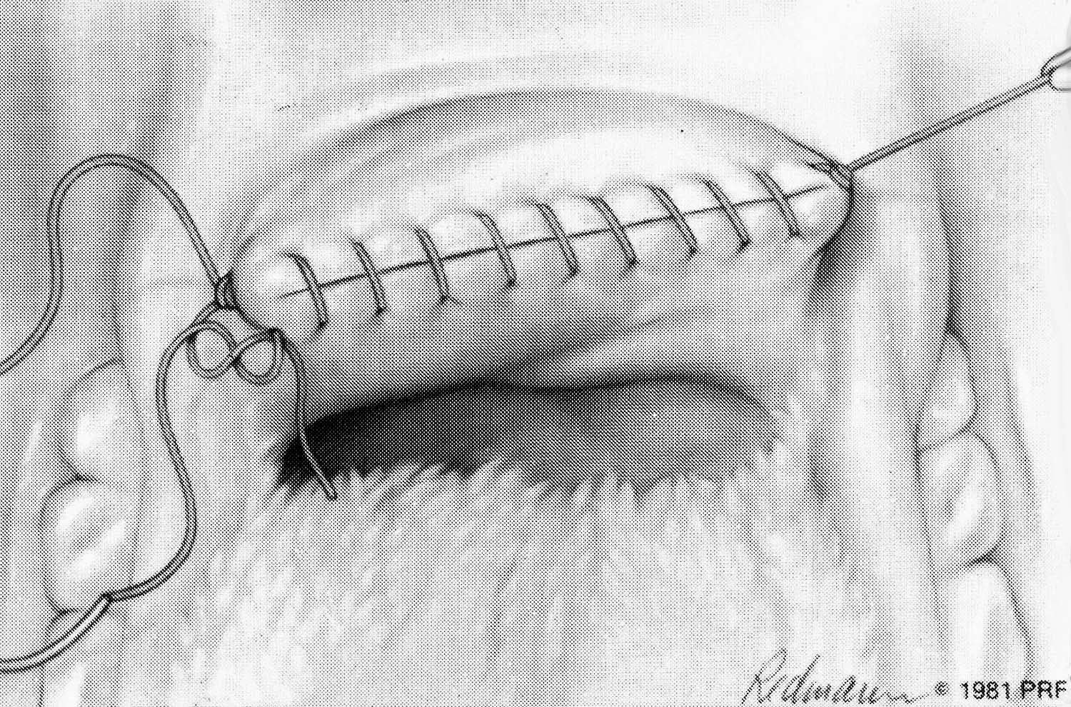 Veterinary Key Points Surgical Correction of Enlongated Soft Palate in