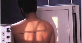Scapular Y Lateral Anterior Oblique Position Shoulder Trauma Radtechonduty