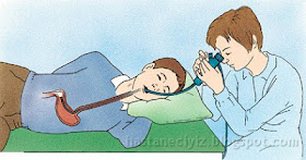 gastroskopi gastroskopi nedir, gastıroskopi, gastroskopi nasıl olur