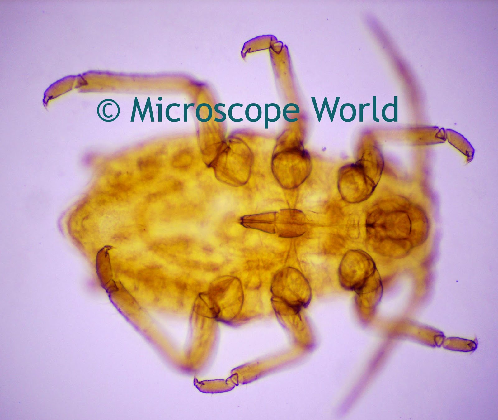 aphid under the microscope at 100x