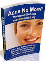  Acne No More