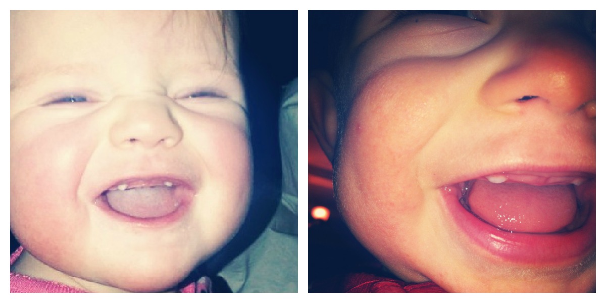 You Auto Know Breaking Teeth