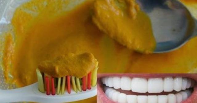 Whiten Your Teeth Naturally in Just 3 Minutes (Video)