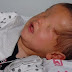 Chinese Boy Born With No Eyes