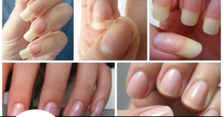 Dr lewinn's renunail nail strengthener review DIY The best homemade nails strengthener | Top Health Remedies
