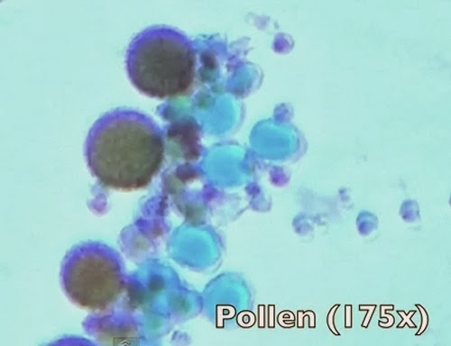 08-Pollen-175x-Magnification-Smartphone-to-Digital-Microscope-Kenji-Yoshino-aka-kmyoshino-www-designstack-co