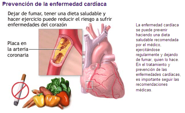 Enfermedades cardiovasculares: ¿Cómo reducir la carga de Enfermedades cardiovasculares: ¿Cómo reducir la carga de