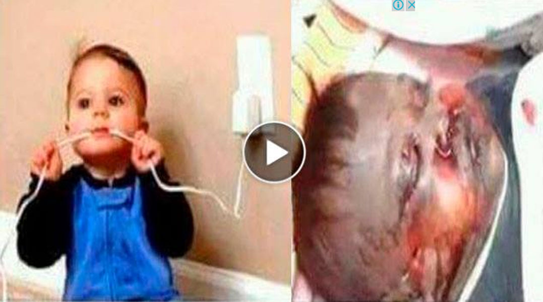 Child Bite Phone Charger and Died Through Electric Shock