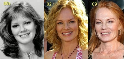 marg helgenberger plastic surgery marg helgenberger plastic surgery