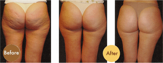 My Life My Adventure My Way What Is Necessary To Get Rid Of