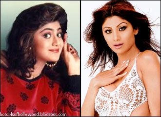 Gauri Khan Plastic Surgery on Shilpa Again Gauri Khan Botox Hair Extensions Gauri Khan Bipasha