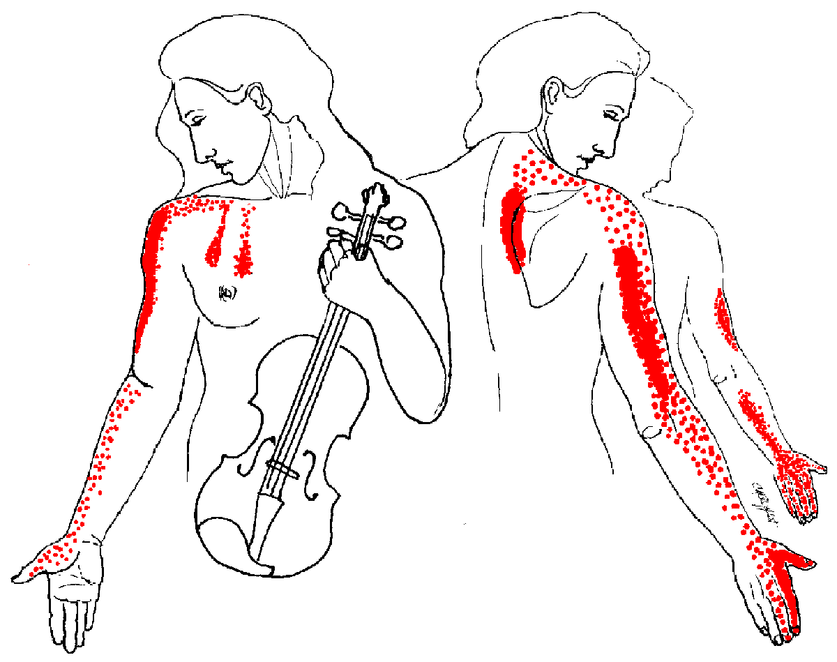thoracic outlet syndrome sleeping position thoracic outlet syndrome sleeping position