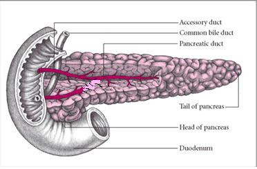 Ashana's life: What is Pancreas Divisum
