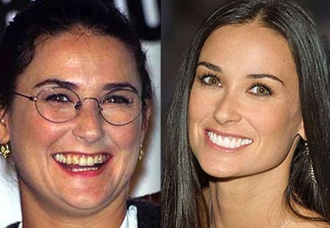 Demi%2BMoore%2BBefore%2BAfter%2BYoung%2BTeeth%2BPlastic%2BSurgery%2BFat%2BBody%2BMess%2BNo%2BMake%2BUp.jpg