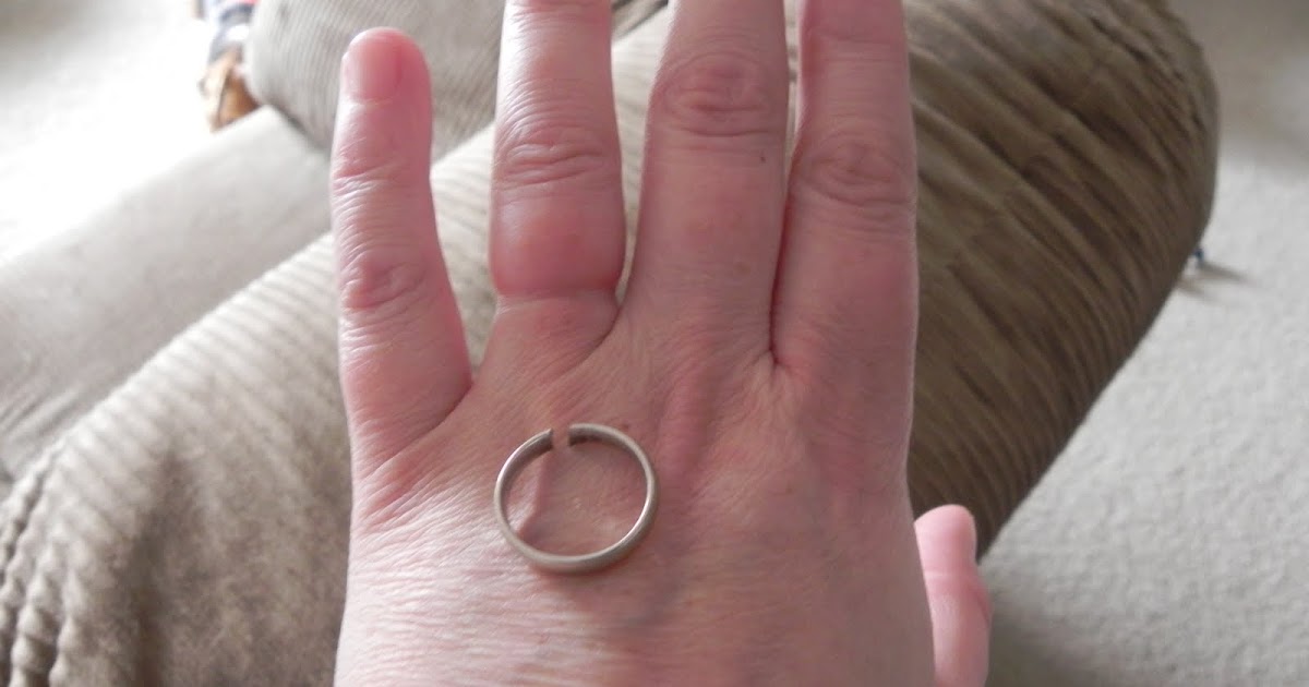 Hoping for our miracle 22w4d My poor wedding band (and finger)