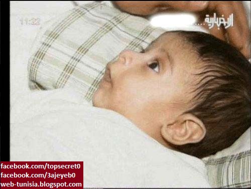  طفل سعودي يبلغ من العمر سنة حامل  Tefl+1