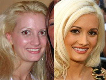 Plastic Surgery Before and After
