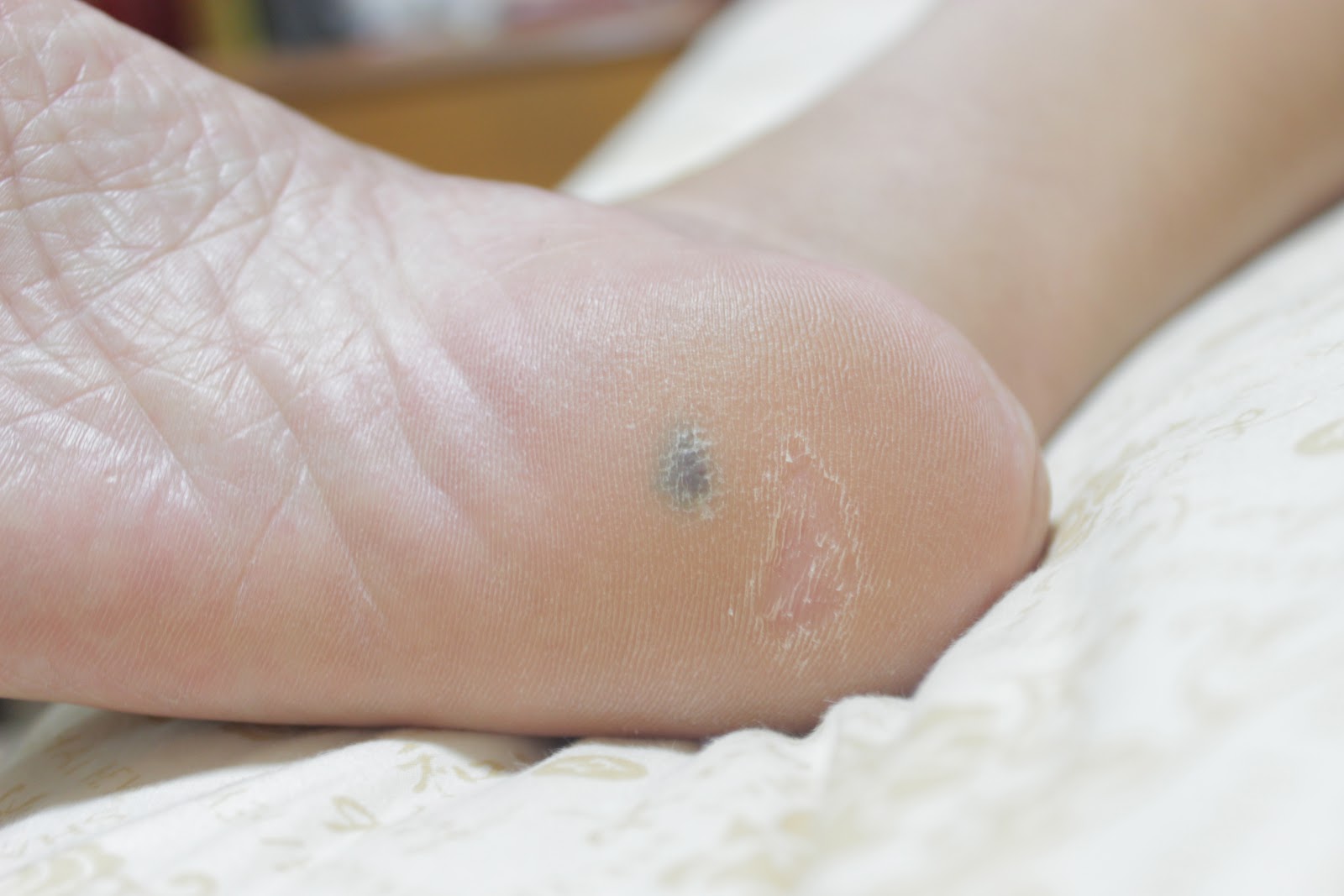 Silver Ang. As Is. Review The Micro Pedi