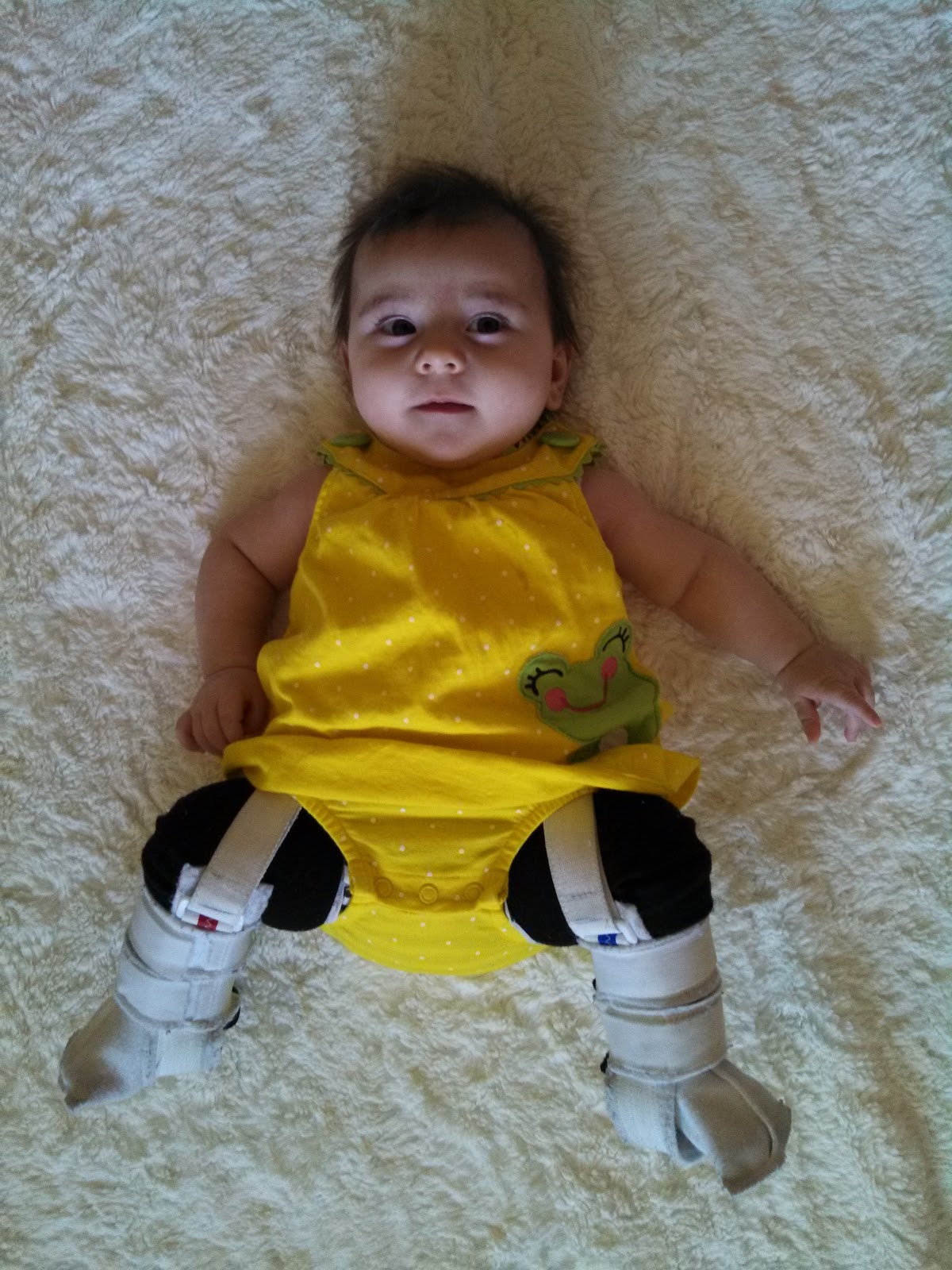 Froggied Princess Our life with a WheatonPavlik Harness It Can Be