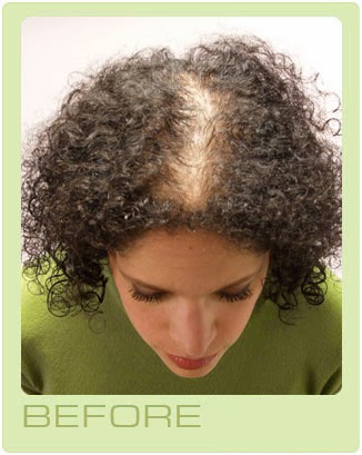 Home Remedies To Thicken Thinning Hair Simple Home Remedies For