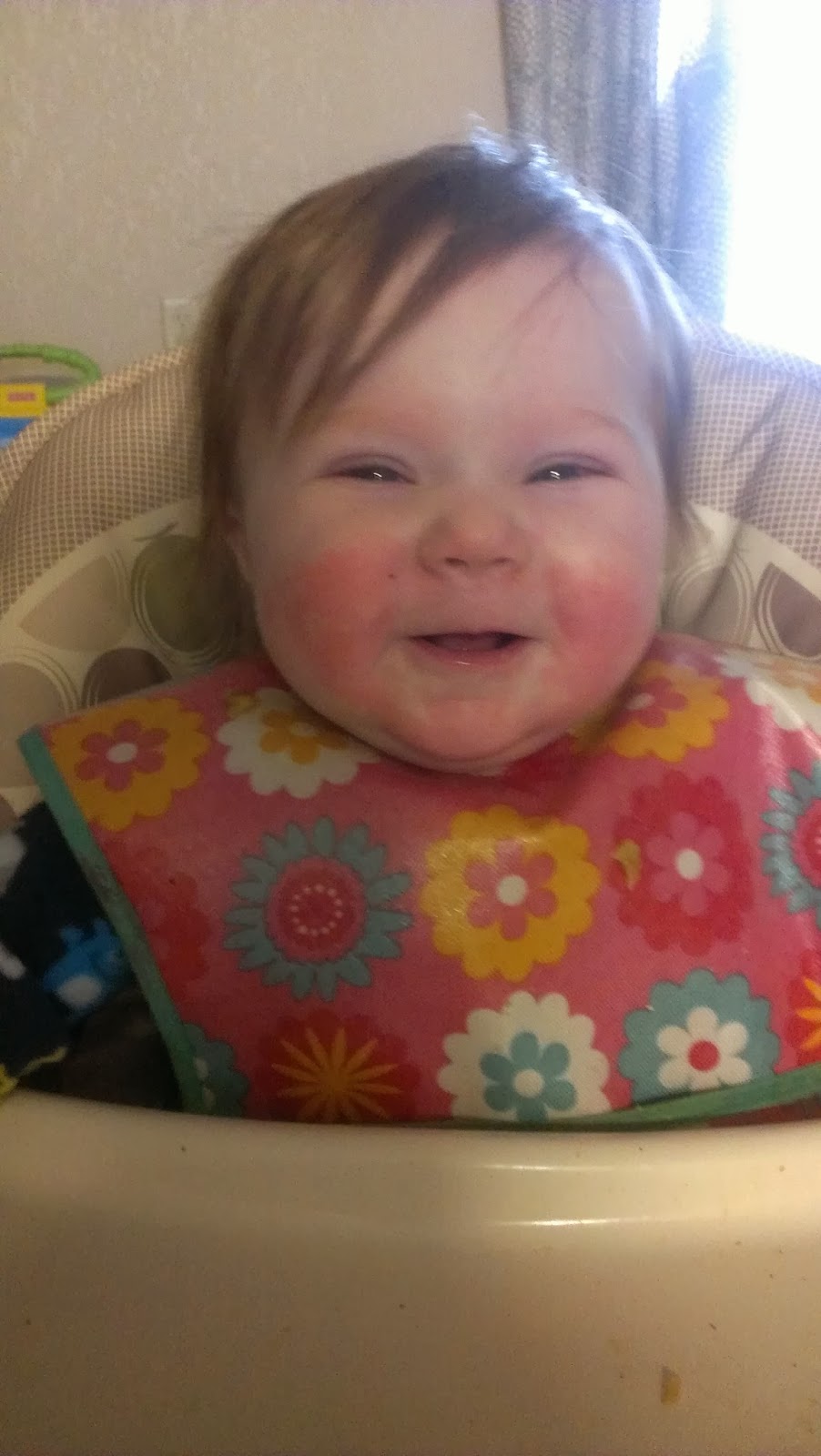 Our Family Beginnings Allergic Reaction to Cottage Cheese