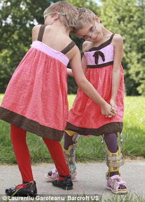 Picture Of Twins Who Live Side By Side And Have Never Looked Into Each Others Eyes. 5 Picture Of Twins Who Live Side By Side And Have Never Looked Into Each Others Eyes. 5