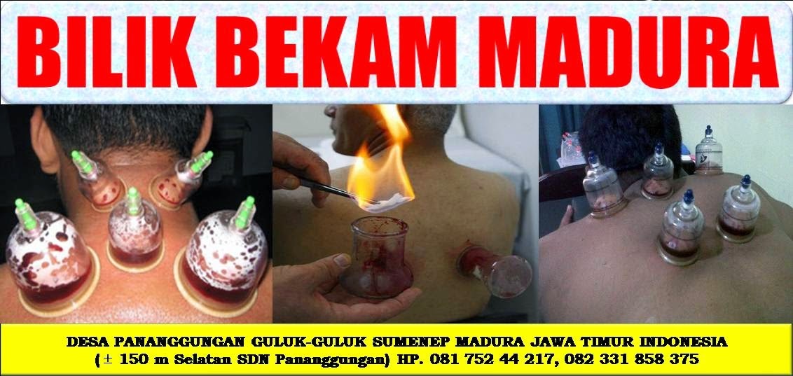 BILIK BEKAM MADURA