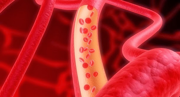 Colesterol: Causas, diagnóstico e gestão