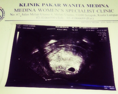 Tahniah,Izreen Azminda juga sudah hamil.