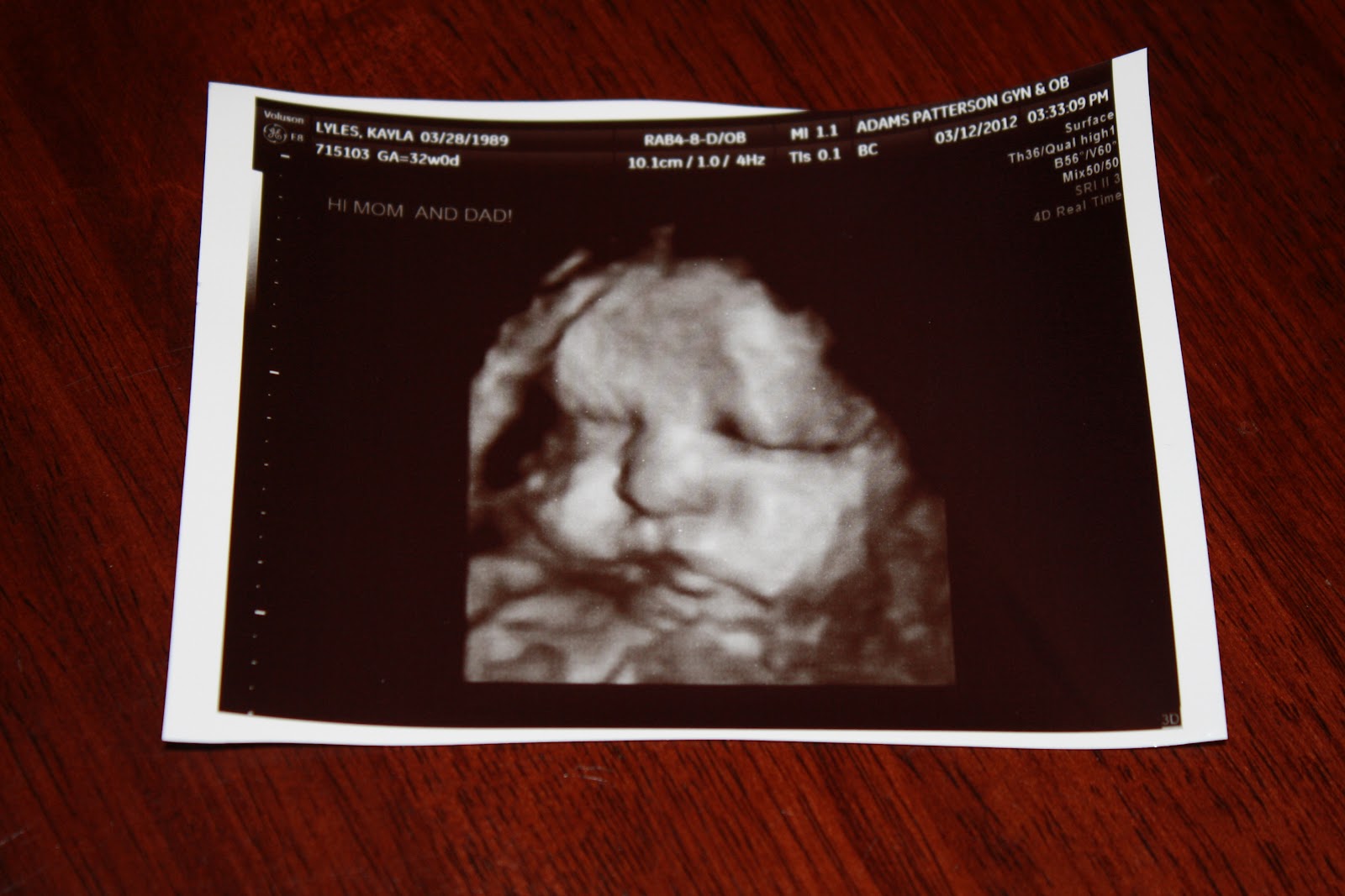 Pregnancy induction medicine, 32 weeks pregnant cant get comfortable