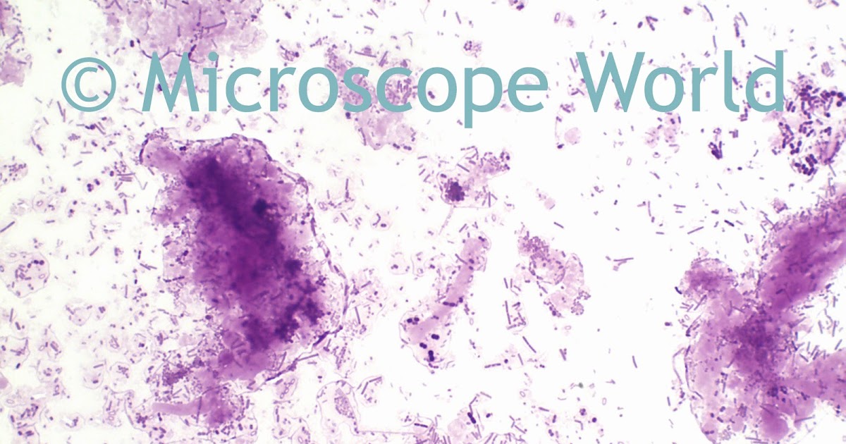 Microscope World Blog A Science Project Dirt, Bacteria and Soap