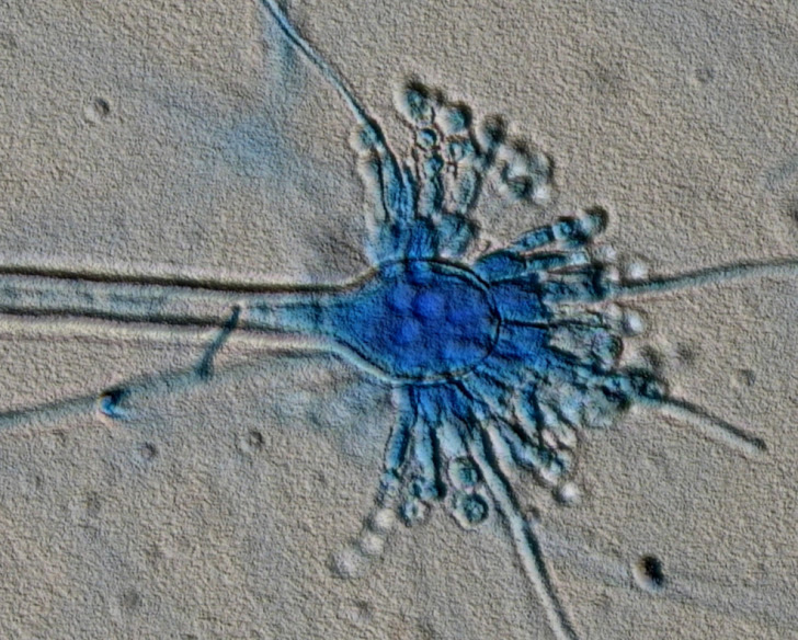 Aspergillus