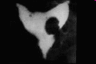 Polyp nội mạc tử cung- Atlas siêu âm tiểu khung