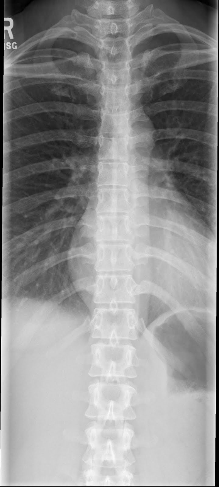 RoadBunner Peace of Mind