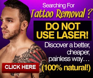 Laserless Tattoos Removal