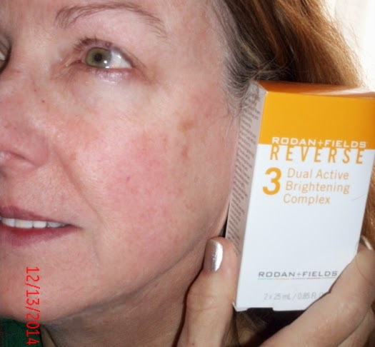 skin dark spots hard remove health beauty treated reverse showing before