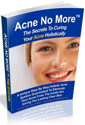 Acne Natural Treatment